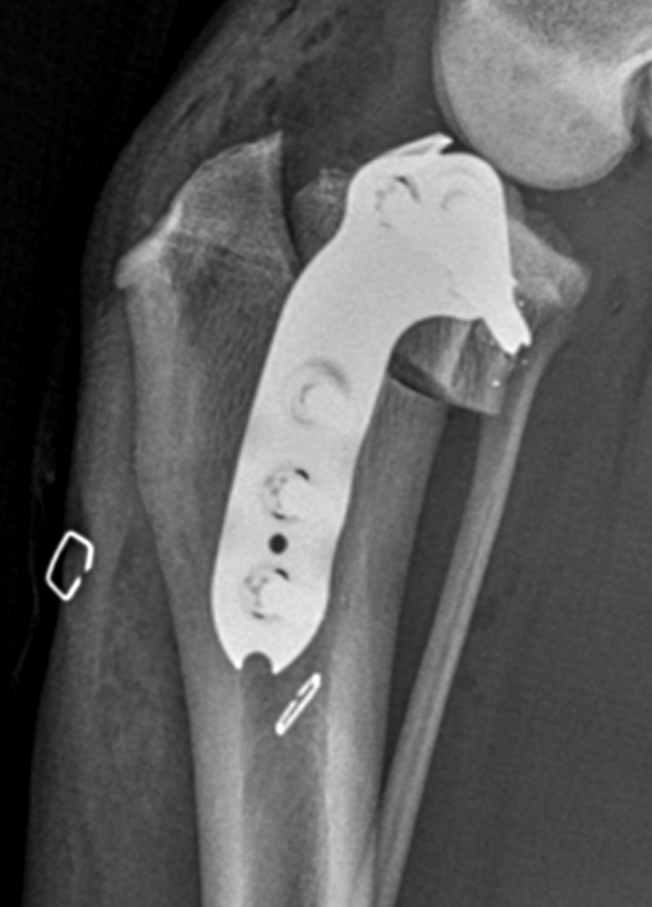 Post-operative radiograph showing the TPLO plate and screws fixed to the tibia